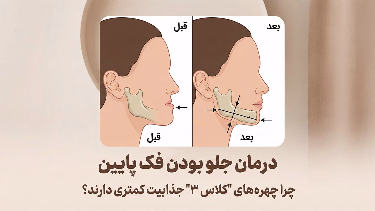 جراحی فک پایین جلو آمده یا پروگناتیسم