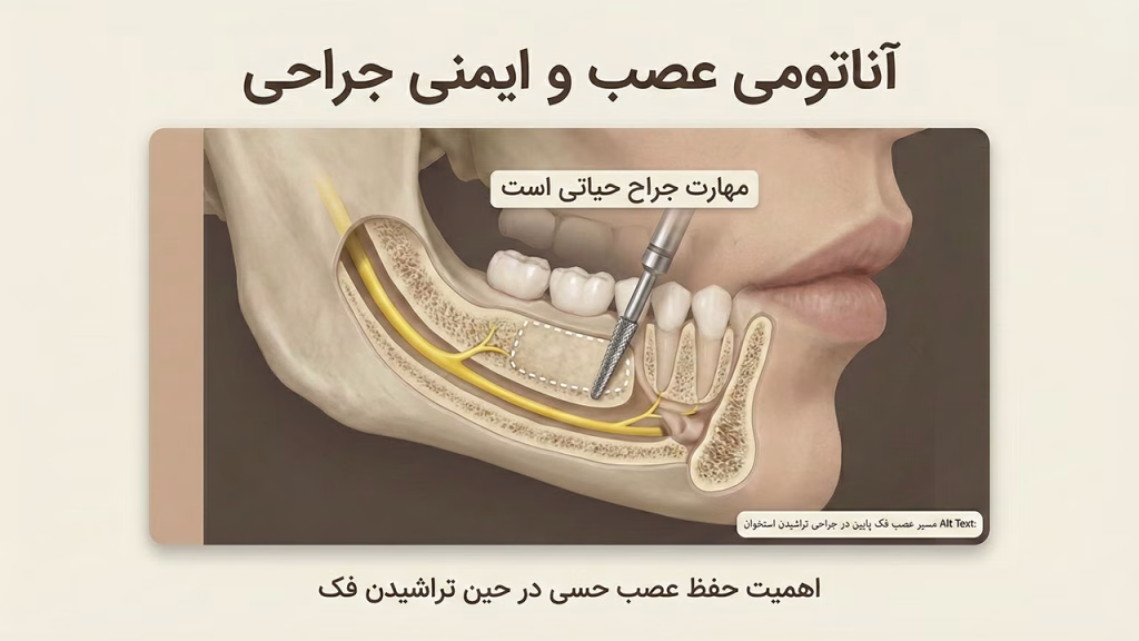 مسیر عصب فک پایین در جراحی تراشیدن استخوان