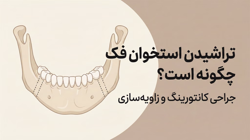 جراحی تراشیدن استخوان فک برای زاویهسازی