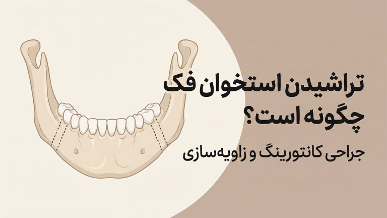 جراحی تراشیدن استخوان فک برای زاویه‌سازی