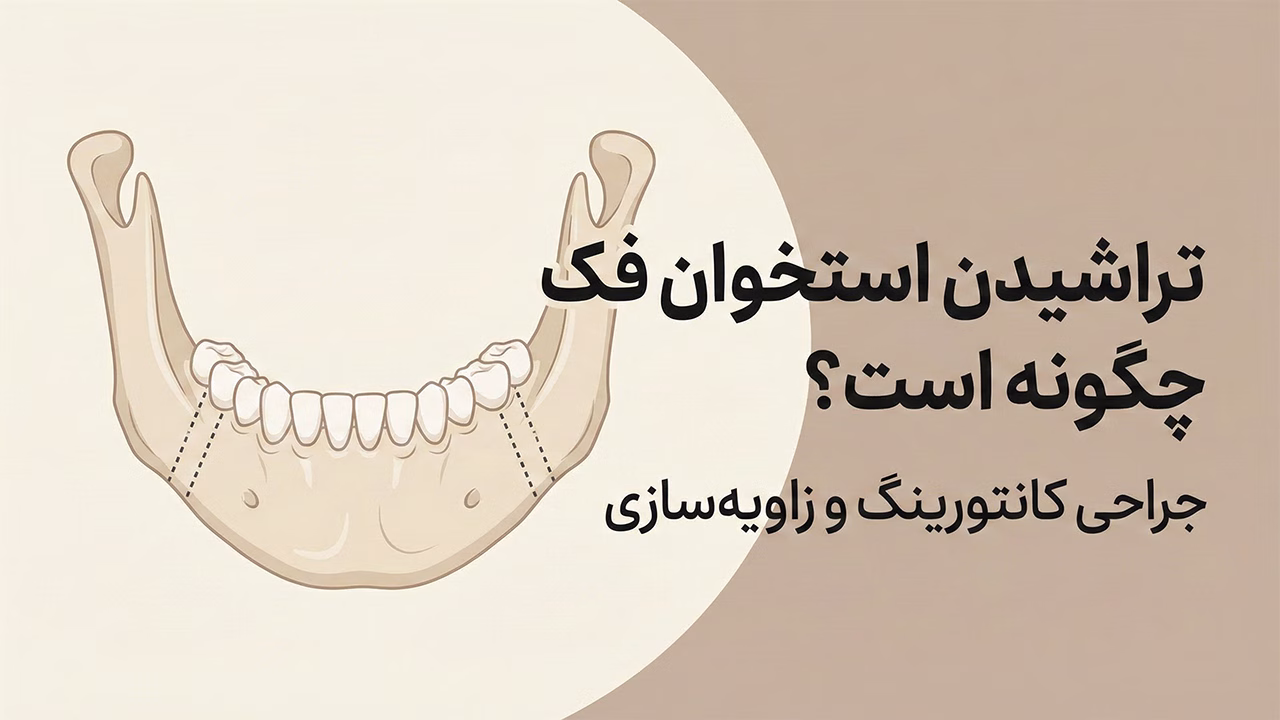 جراحی تراشیدن استخوان فک برای زاویه‌سازی