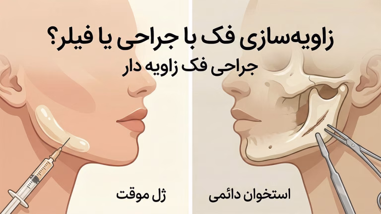 مقایسه زاویه سازی فک با جراحی و فیلر