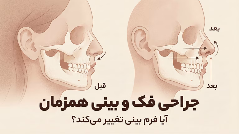تغییرات بینی بعد از جراحی فک و صورت