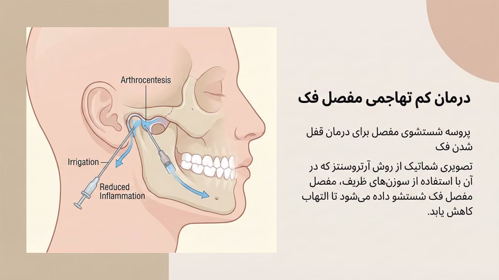 شستشوی مفصل فک یا آرتروسنتز