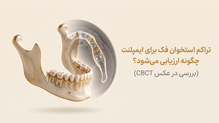ارزیابی تراکم استخوان فک برای ایمپلنت در تصویربرداری CBCT
