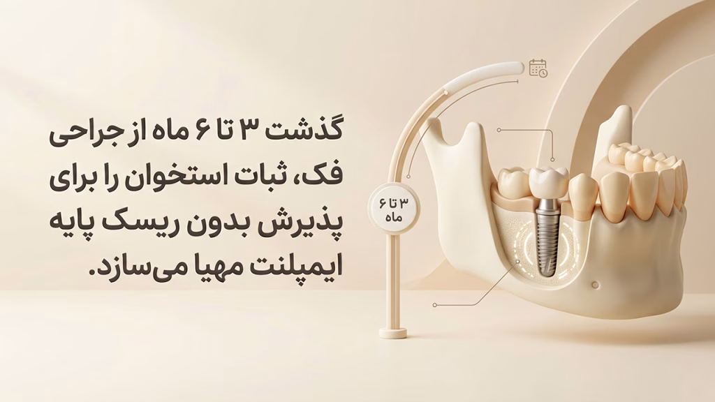 زمان مناسب کاشت ایمپلنت بعد از جراحی فک ارتوگناتیک