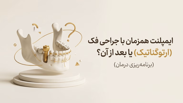 کاشت ایمپلنت بعد از جراحی فک ارتوگناتیک