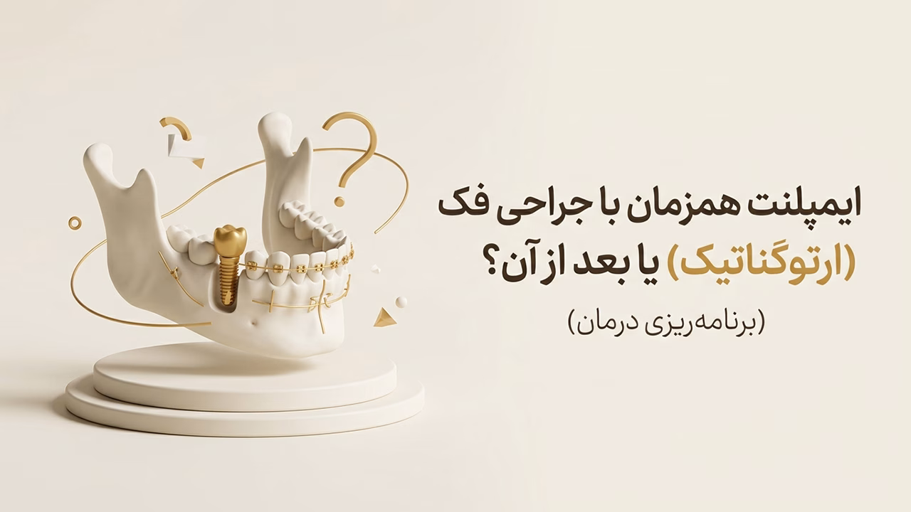 کاشت ایمپلنت بعد از جراحی فک ارتوگناتیک