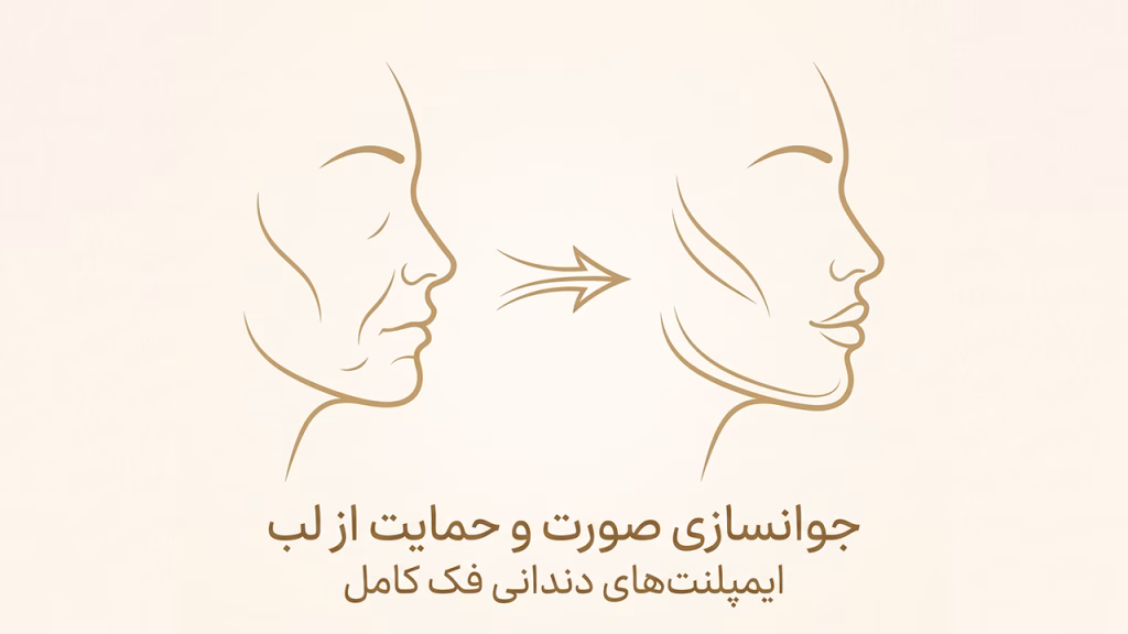 جوانسازی چهره و اصلاح فرم لب بعد از ایمپلنت کامل فک