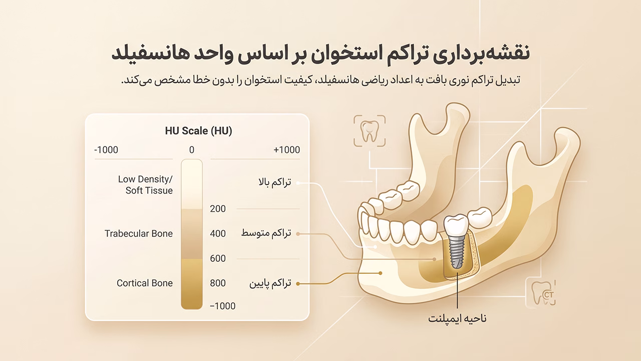 مقیاس هانسفیلد برای تعیین تراکم استخوان فک برای ایمپلنت