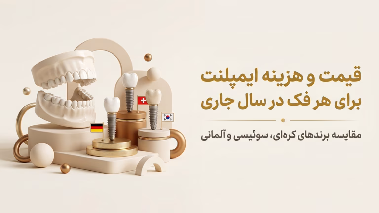مقایسه برندهای ایمپلنت کره‌ای، آلمانی و سوئیسی در هزینه ایمپلنت هر فک