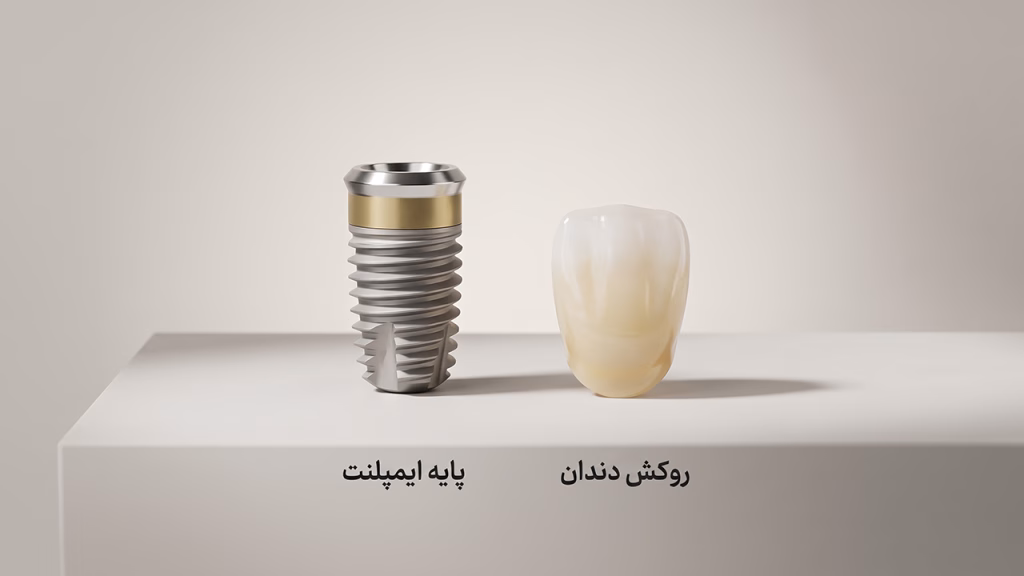 تفاوت برندهای ایمپلنت و روکش زیرکونیا در هزینه فک کامل