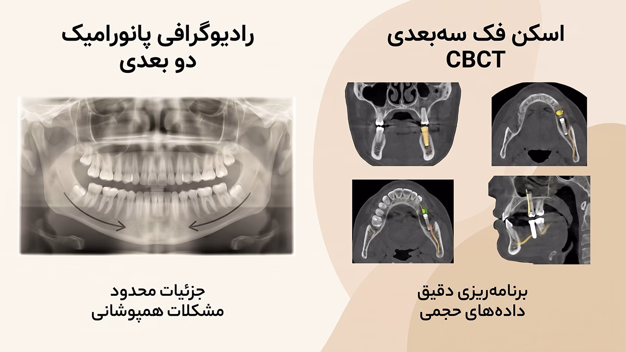 مقایسه رادیوگرافی پانورامیک دو بعدی و سی تی اسکن سه بعدی CBCT فک