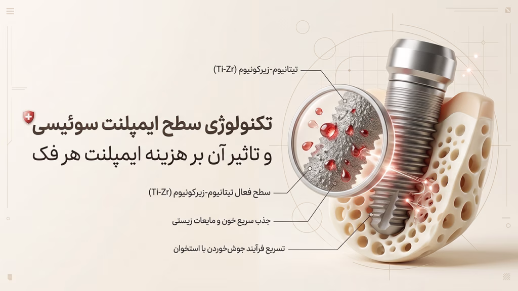 فناوری سطحی ایمپلنت سوئیسی و تاثیر آن بر هزینه ایمپلنت هر فک