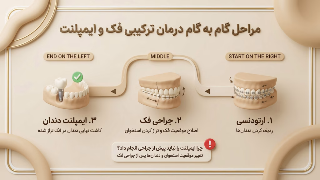 نقشه راه و ترتیب ارتودنسی، جراحی فک و کاشت ایمپلنت