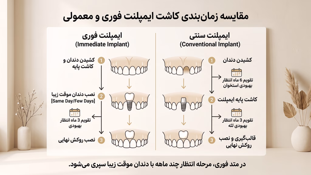 تفاوت ایمپلنت سنتی و ایمپلنت فوری فک بالا