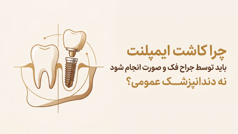 ایمپلنت توسط جراح فک و صورت و تضمین موفقیت جراحی