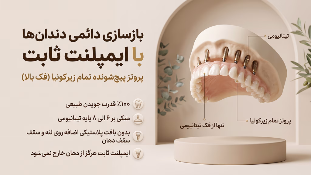 پروتز پیچ شونده تمام زیرکونیا در ایمپلنت ثابت فک بالا
