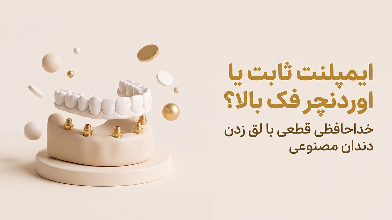 مقایسه ایمپلنت ثابت فک بالا با دندان مصنوعی متحرک سنتی