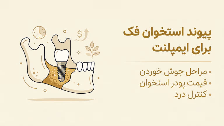 پیوند استخوان فک برای ایمپلنت با پودر استخوان و ممبرین