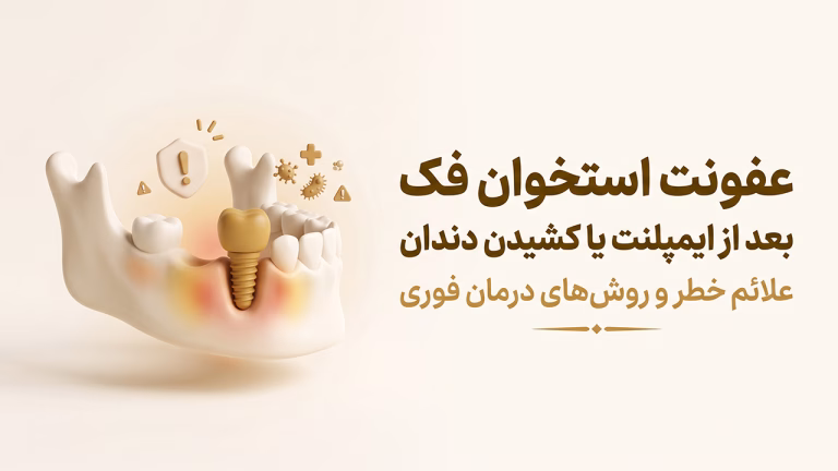 عفونت استخوان فک بعد از ایمپلنت و کشیدن دندان