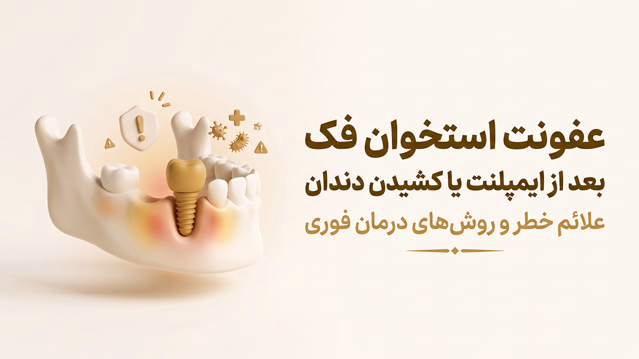 عفونت استخوان فک بعد از ایمپلنت و کشیدن دندان