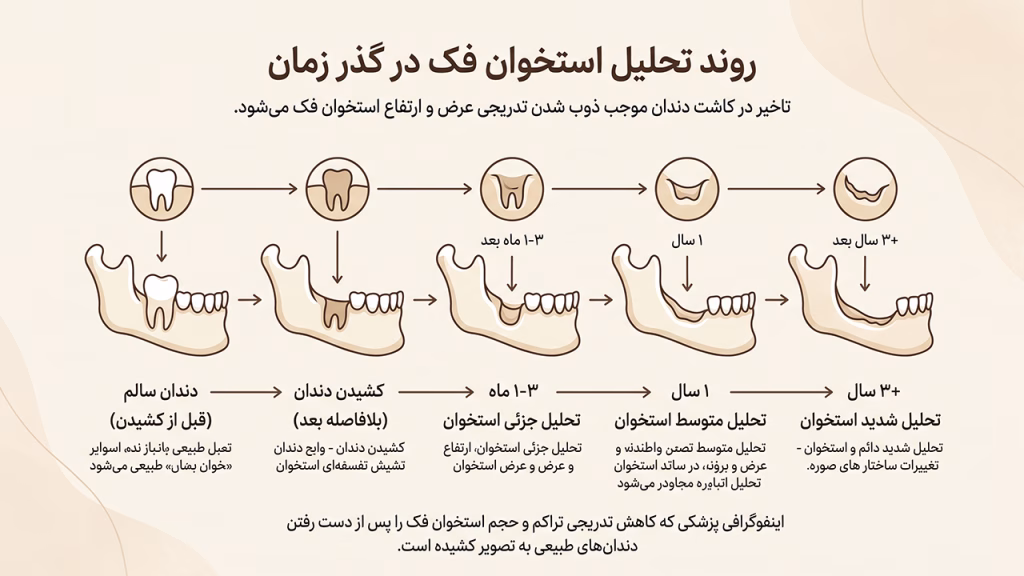 مراحل تحلیل رفتن استخوان فک بعد از کشیدن دندان