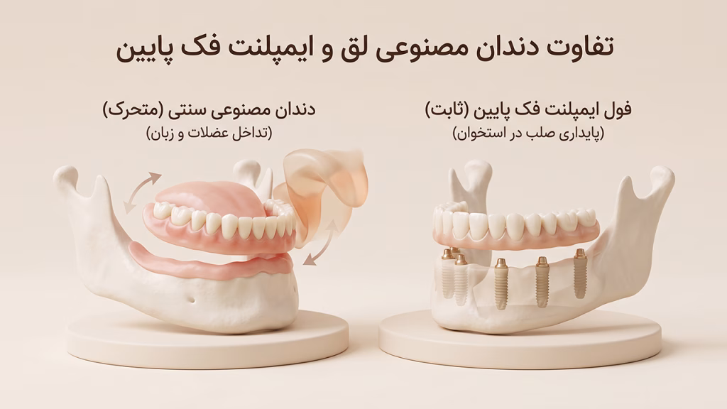 ناپایداری دندان مصنوعی در برابر ثبات فول ایمپلنت فک پایین