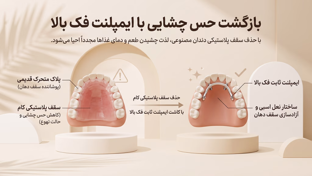 حذف سقف پلاستیکی کام با کاشت ایمپلنت ثابت فک بالا
