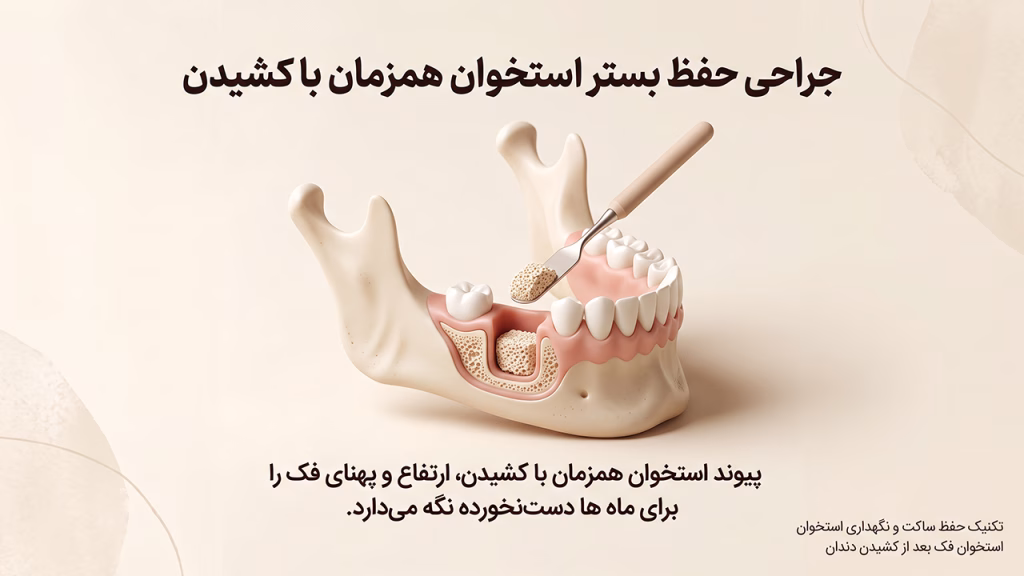 تکنیک حفظ ساکت و نگهداری استخوان فک بعد از کشیدن دندان